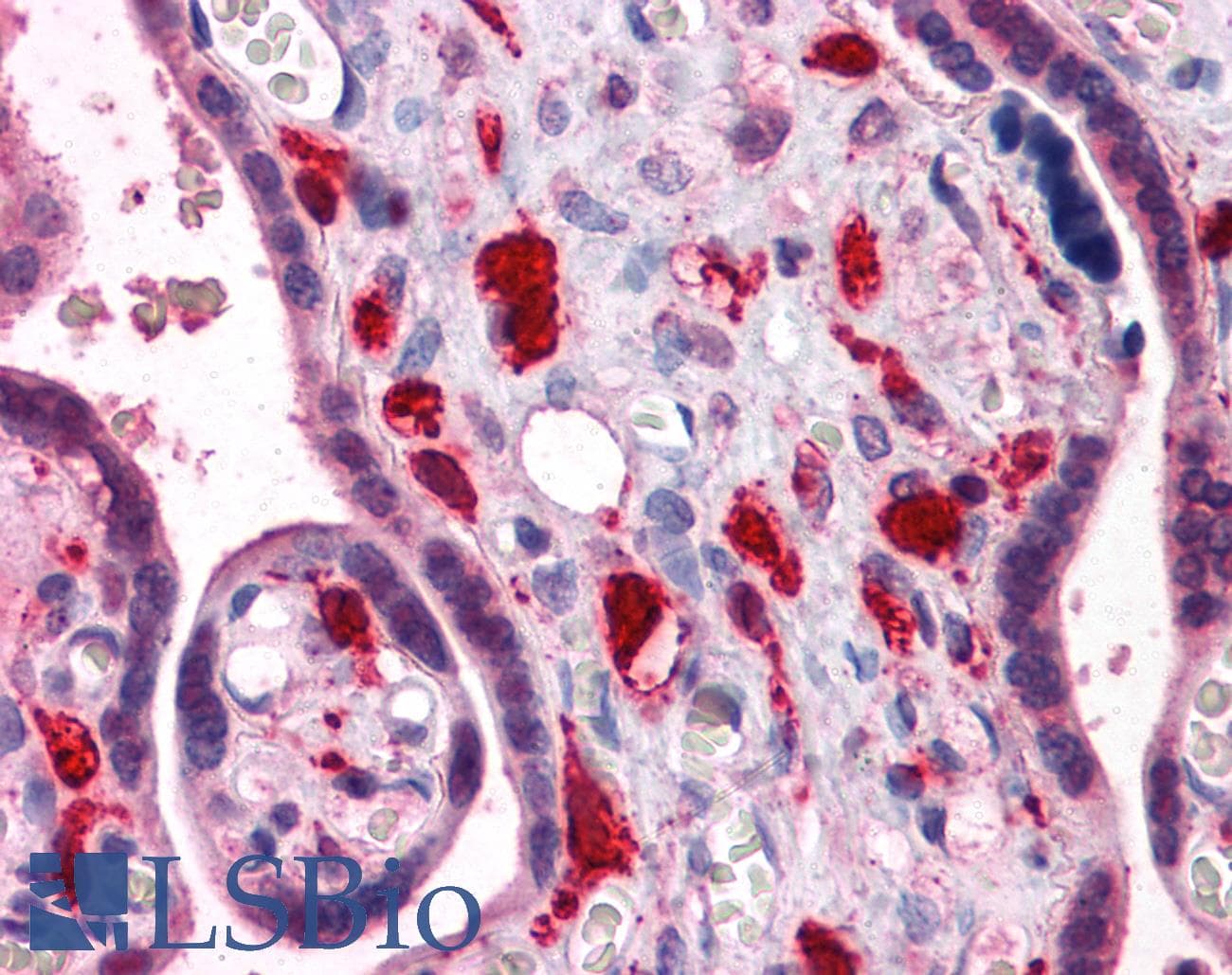IHC-plus™ Monoclonal Mouse anti-Human SMAD6 Antibody (clone 1G2, IHC, WB)
