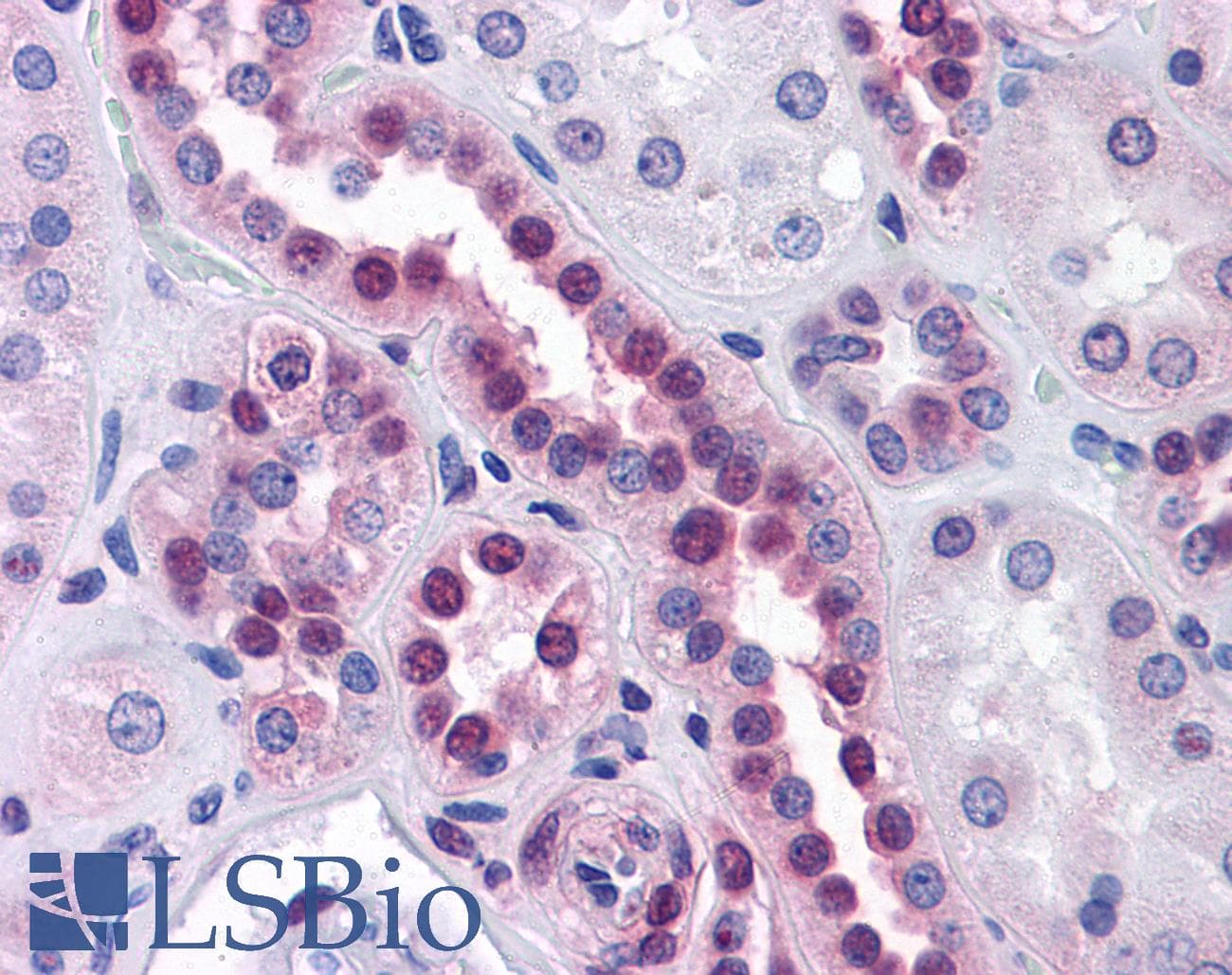 IHC-plus™ STK33 Antibody (clone 3F10)