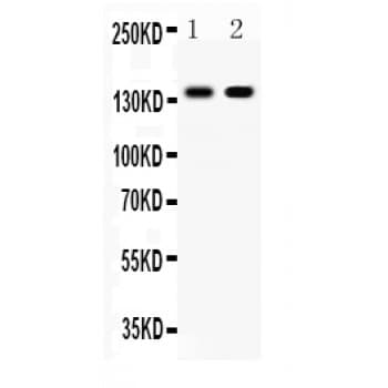 CDH1 / E Cadherin Antibody (aa286-703)