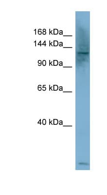 Polyclonal Rabbit anti-Human PLCB1 / Phospholipase C Beta 1 Antibody (C-Terminus, WB)
