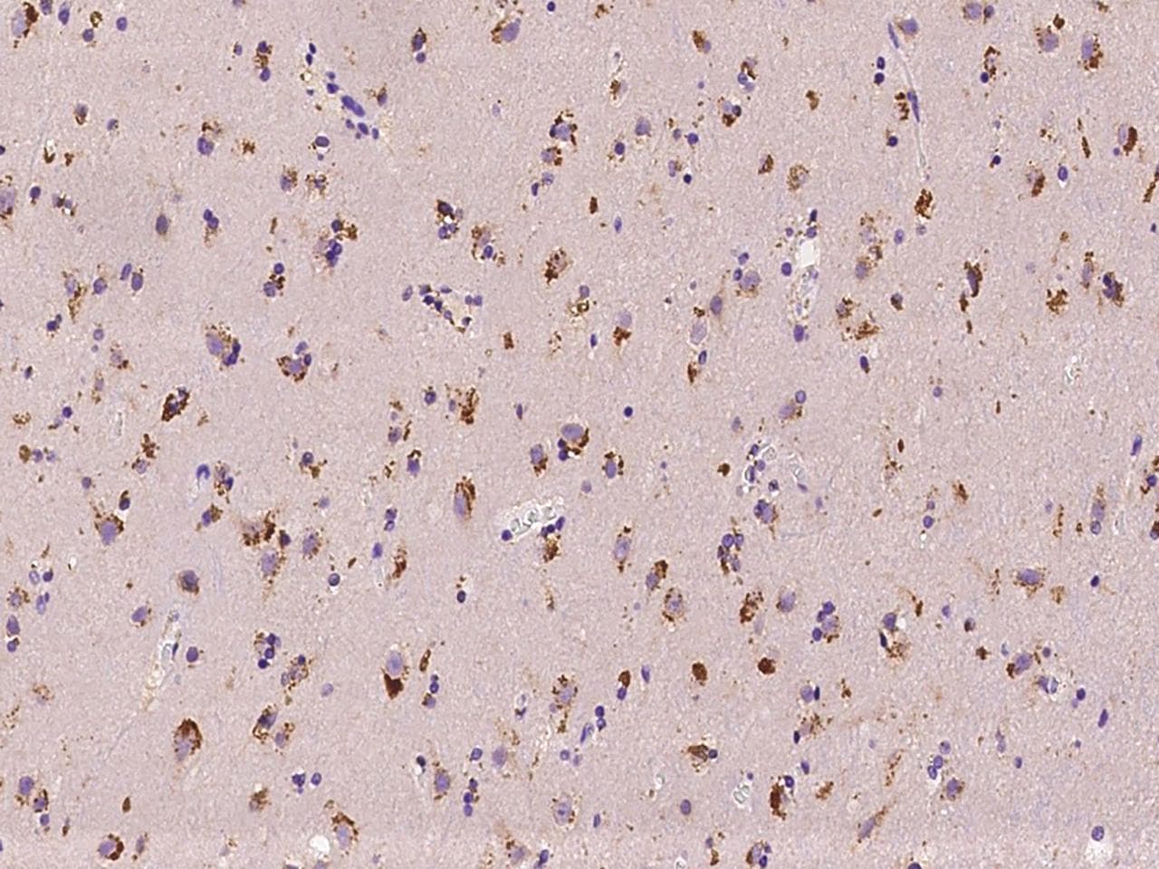 Polyclonal Rabbit anti-Human LIMK1 / LIMK Antibody (IHC)