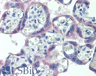 IHC-plus™ Polyclonal Rabbit anti-Human FBN2 / Fibrillin 2 Antibody (IHC, WB)