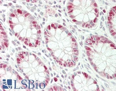 IHC-plus™ Polyclonal Rabbit anti-Human HAT1 Antibody (aa389-419, IHC, WB)