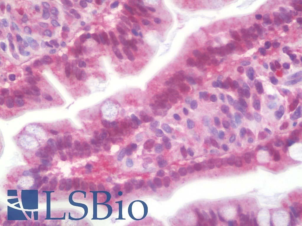 IHC-plus™ PYCARD / ASC / TMS1 Antibody (aa10-59)