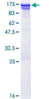 Human VCP Protein (Recombinant GST)