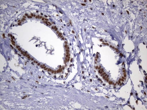 Monoclonal Mouse anti-Human MSH2 Antibody (clone UMAB259, Carrier-free, aa1-304, IHC)