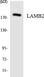 LAMB2 / Laminin Beta 2 Antibody (aa42-91)