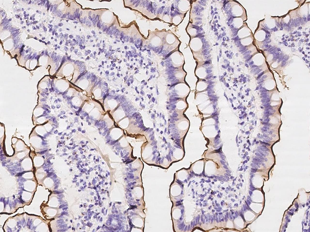 SLC5A1 / SGLT1 Antibody