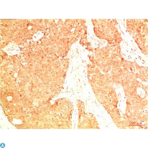TP53 / p53 Antibody