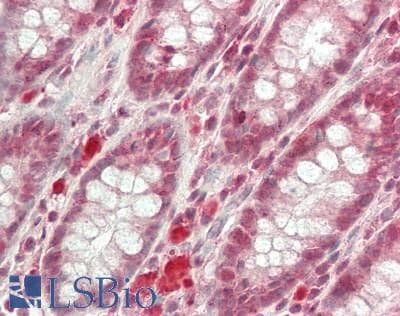 IHC-plus™ MDM4 / MDMX Antibody (clone 4G3)