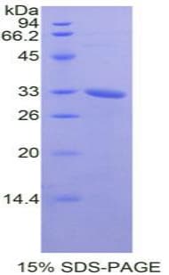 Mouse NEK2 Protein (Recombinant His-T7)