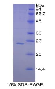 Human GSS / Glutathione Synthetase Protein (Recombinant His)