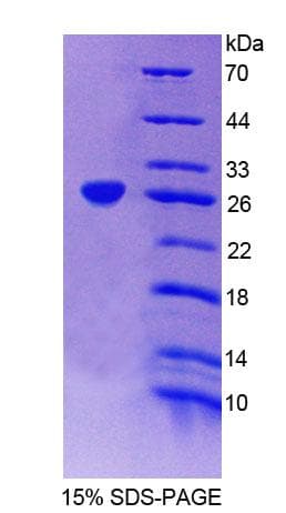 Human TRIM21 / RO52 Protein (Recombinant His-T7, N-terminus)
