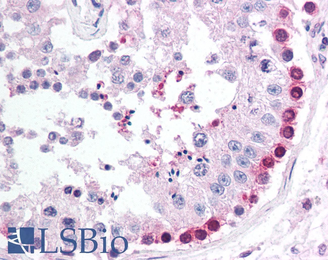IHC-plus™ PINK1 Antibody (aa484-504)