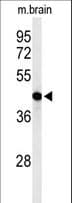 AGPAT6 Antibody (aa45-74)