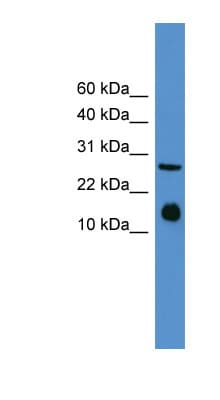 Polyclonal Rabbit anti-Mouse IL5 Antibody (aa21-70, WB)