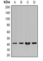 Polyclonal Rabbit anti-Human HLA-A Antibody (IHC, IF, WB)