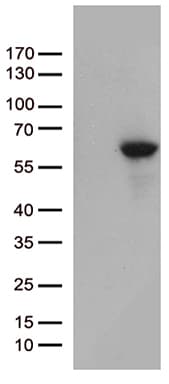 MMP11 Antibody (aa239-488, clone OTI2D7, Carrier-free)
