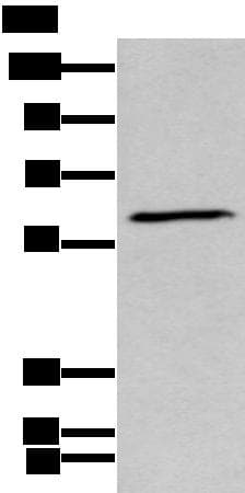 GPC5 / Glypican 5 Antibody