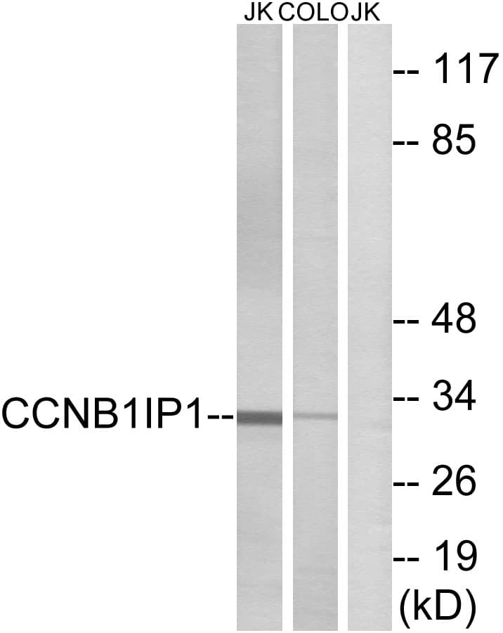 Polyclonal Rabbit anti-Human CCNB1IP1 Antibody (aa201-250, WB)