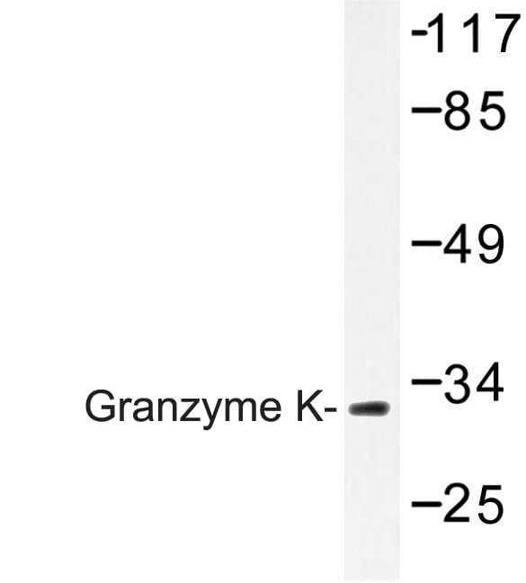 GZMK / Granzyme K Antibody (His85)