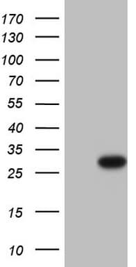 PTCH1 / Patched 1 Antibody (aa770-1027, clone OTI6C10)