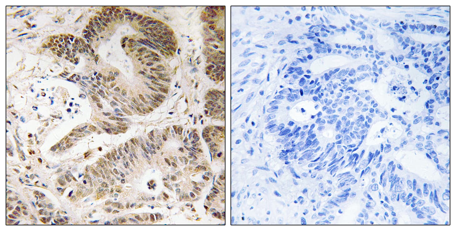 PIK3R5 Antibody (aa695-744)