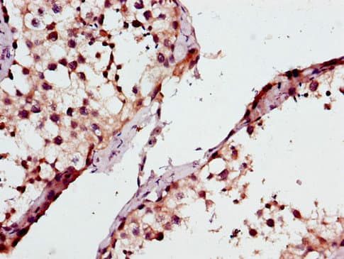 Polyclonal Rabbit anti-Human ATP8A2 Antibody (IHC, IF)