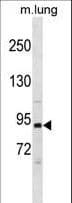 PIK3R1 / p85 Alpha Antibody (aa56-84)
