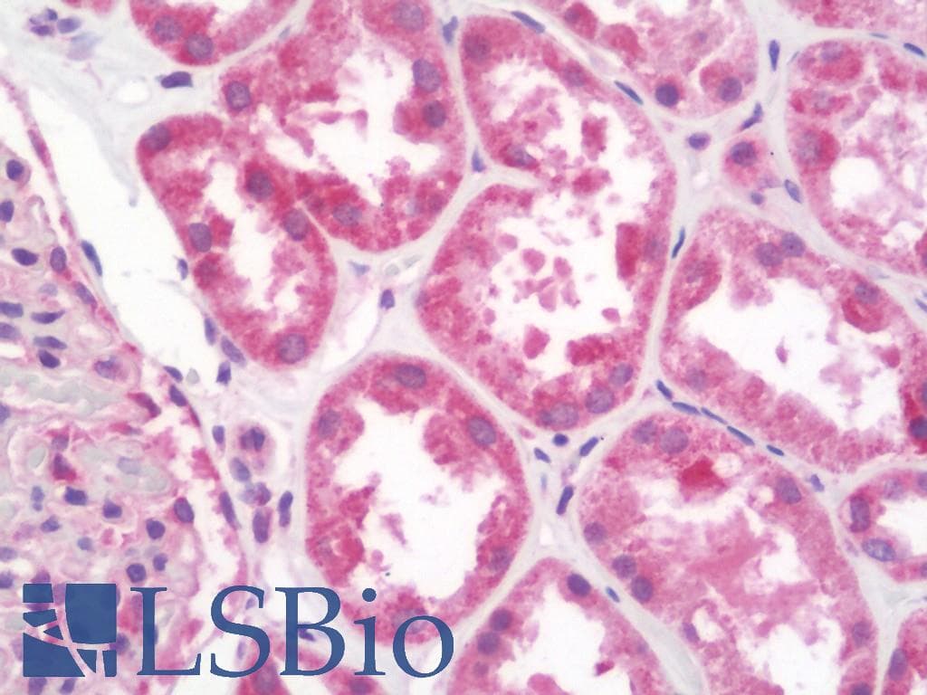 IHC-plus™ Polyclonal Rabbit anti-Human QTRT1 Antibody (IHC, WB)