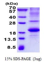Human SLAMF1 / SLAM / CD150 Protein (Recombinant His)