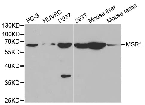 Polyclonal Rabbit anti-Human MSR1 / CD204 Antibody (IF, WB)