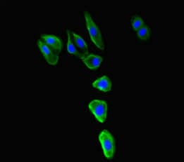 Polyclonal Rabbit anti-Human MR1 Antibody (IHC, IF, WB)