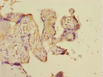 CSRNP2 / FAM130A1 Antibody