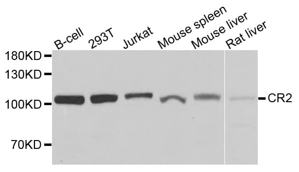 Polyclonal Rabbit anti-Human CR2 / CD21 Antibody (WB)