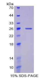 Rat GPI Protein (Recombinant His-T7)