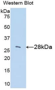 IGFBP2 / IGF-BP53 Antibody (aa35-304)