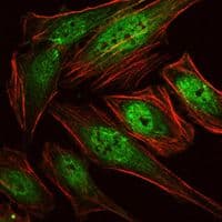 Monoclonal Mouse anti-Human AML1 / RUNX1 Antibody (clone 5A1, IF, WB)
