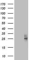 Monoclonal Mouse anti-Human CD63 Antibody (clone OTI2D5, WB)