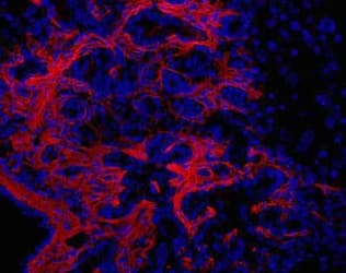 Oval Cell Marker OC2 Antibody (clone OC2-1C6)