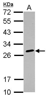 HLA-DQB2 Antibody