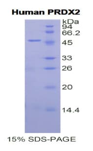 Human PRDX2 / Peroxiredoxin 2 Protein (Recombinant His-GST)
