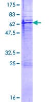 Human CTSH / Cathepsin H Protein (Recombinant GST)