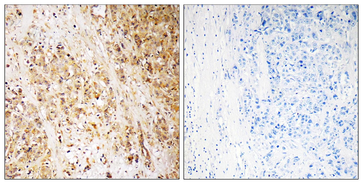 HMMR / CD168 / RHAMM Antibody