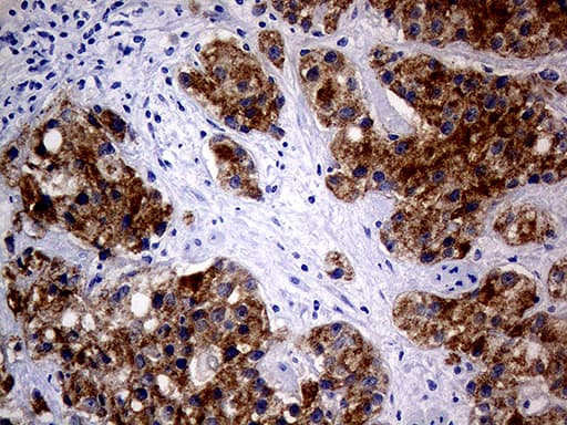 AMACR / P504S Antibody (clone OTI4D12)