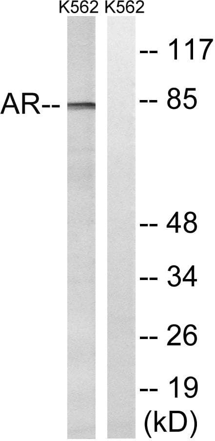 Polyclonal Rabbit anti-Human AR / Androgen Receptor Antibody (p363, WB)