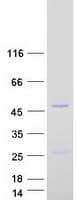 Human LACC1 Protein (Recombinant Myc-DDK (Flag))