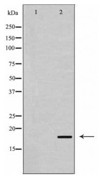 Polyclonal Rabbit anti-Human CDKN2C / p18 INK4c Antibody (IHC, WB)