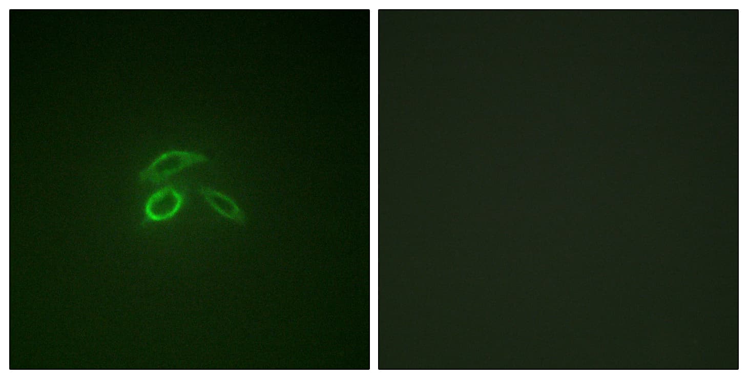 EMA / MUC1 Antibody (phospho-Tyr1229)