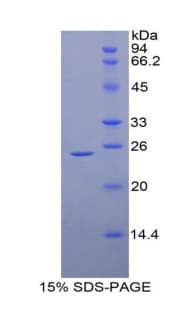 Mouse HSPB1 / HSP27 Protein (Recombinant His)